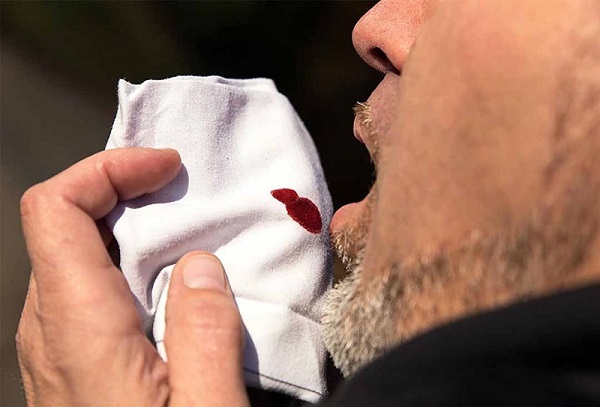 Ho ra máu không thể chủ quan – Cảnh báo sức khỏe phổi