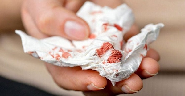 Bệnh phổi gây ho ra máu – Những dấu hiệu cảnh báo sớm