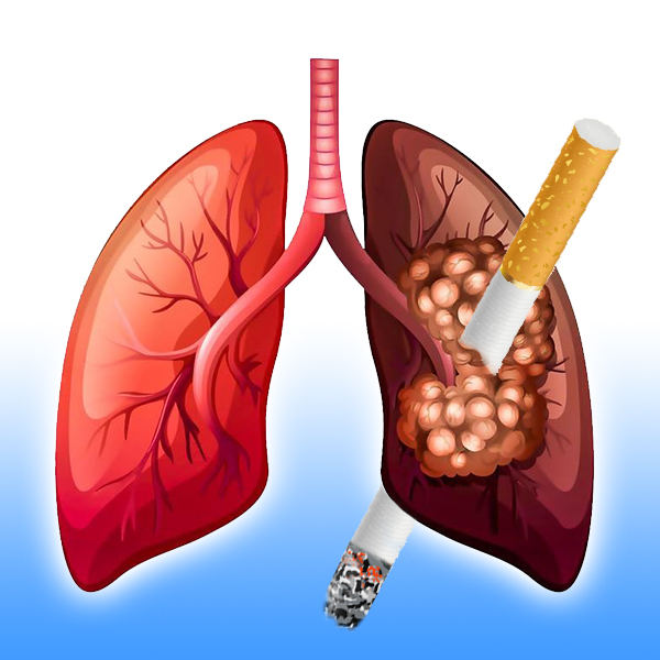 Khói thuốc tàn phá tế bào phổi