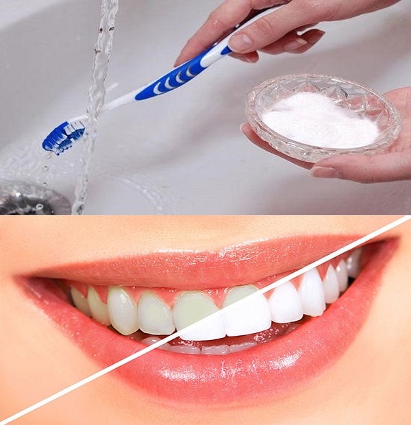 Hiệu quả làm trắng răng của kem đánh răng thường chỉ dừng lại ở mức làm sạch bề mặt, khó thay đổi màu răng gốc