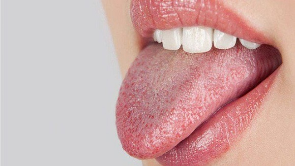 Khô miệng gây hôi miệng là vấn đề phổ biến nhưng dễ bị bỏ qua