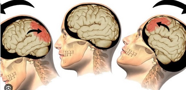 Căng thẳng, thói quen xấu và chế độ ăn nghèo nàn góp phần gây hại não bộ