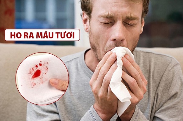 Viêm phổi và lao phổi - Sự khác biệt và dấu hiệu nhận biết
