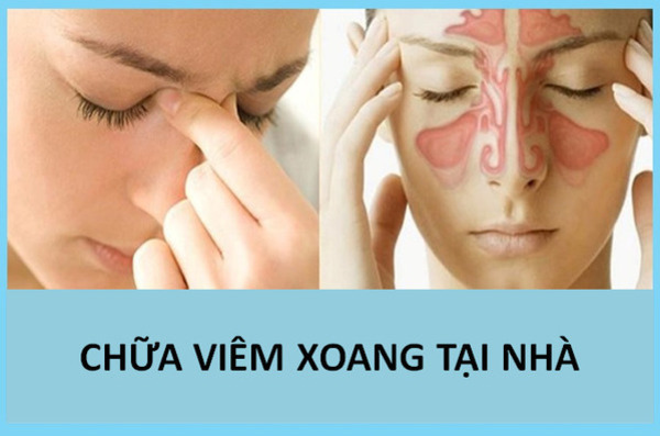 Nguyên nhân và triệu chứng viêm xoang
