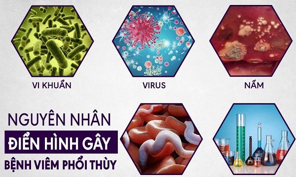 Ảnh: Sống khoẻ cùng phổi – hãy bắt đầu từ những thói quen lành mạnh và lựa chọn dược liệu uy tín.