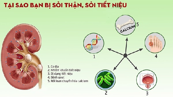 Thói quen, chế độ ăn và hormone ảnh hưởng đến sỏi mật