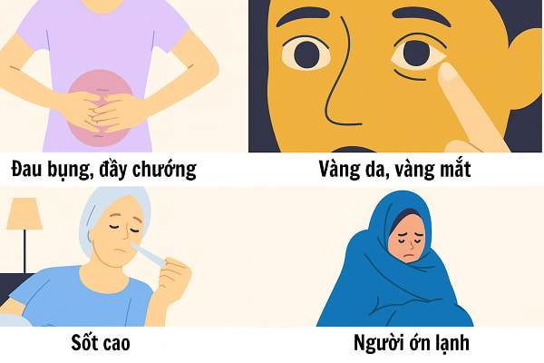 Nhận biết bệnh sỏi mật sớm để phòng ngừa hiệu quả