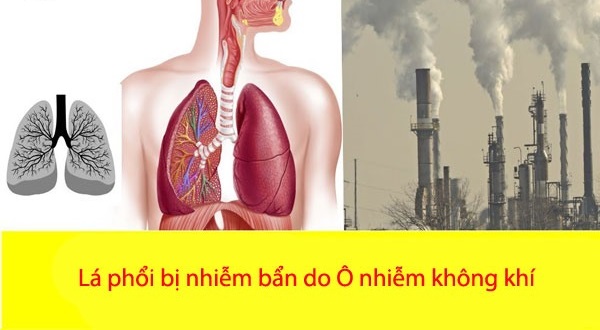 Giải pháp chăm sóc bảo vệ phổi hiệu quả, an toàn