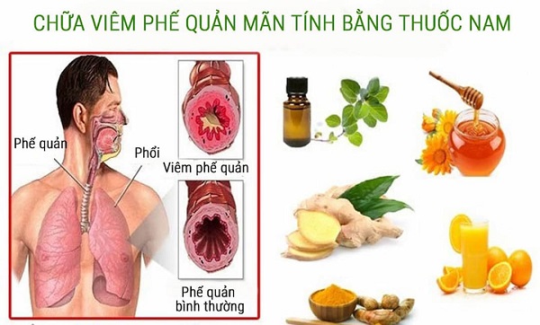 Hình ảnh xông hơi bằng lá bạch đàn và các dược liệu khác cho người bệnh phổi