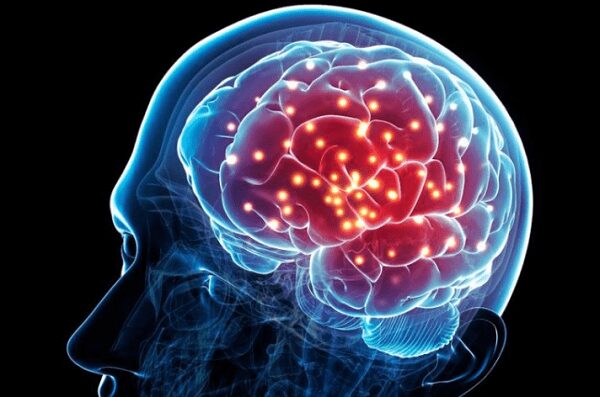 Các yếu tố ảnh hưởng sức khỏe não bộ