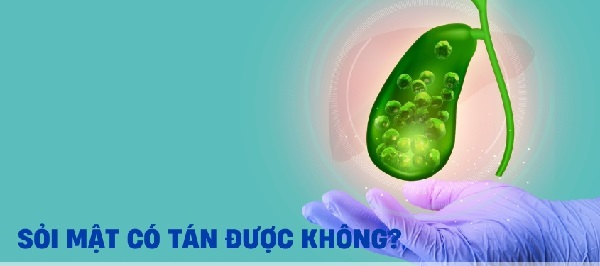 Sỏi mật là gì? Dấu hiệu và nguy cơ biến chứng