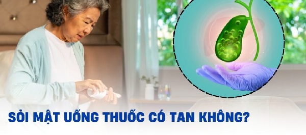 Khả năng tự tan của sỏi mật và các yếu tố ảnh hưởng