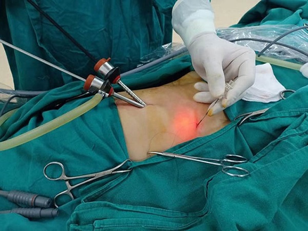 Sử dụng thảo dược trong hỗ trợ điều trị sỏi mật
