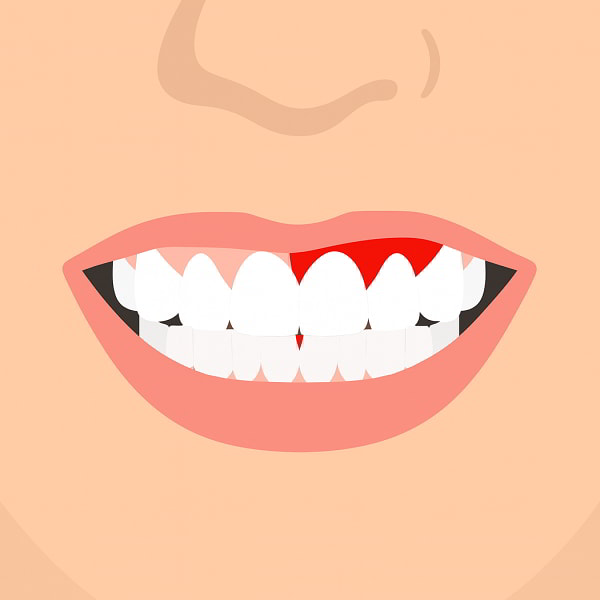 Thực phẩm giàu vitamin C giúp phòng ngừa scorbut