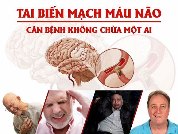 Chế độ dinh dưỡng hỗ trợ phục hồi và bảo vệ trí não