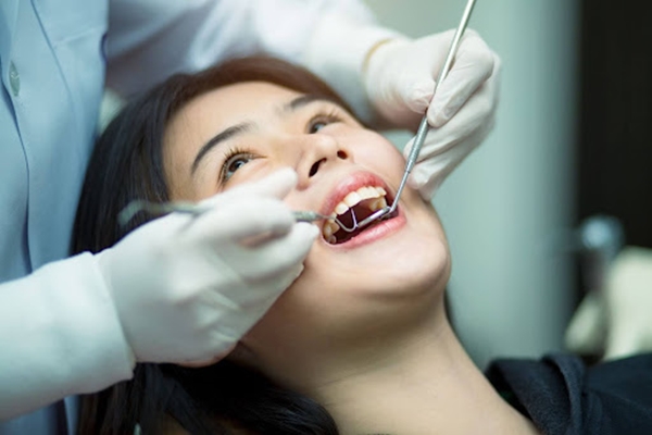 So sánh trước và sau khi cạo vôi răng