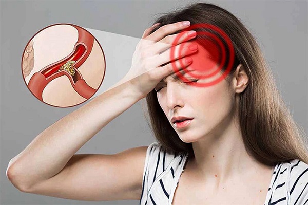 Tác động của thiếu máu não đến thần kinh và trí nhớ