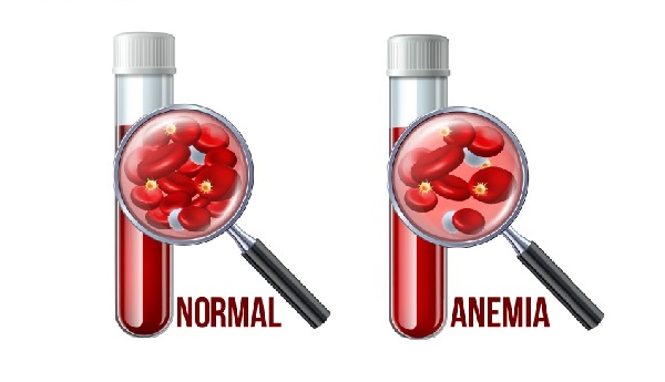 Vai trò của sắt trong dinh dưỡng và sức khỏe