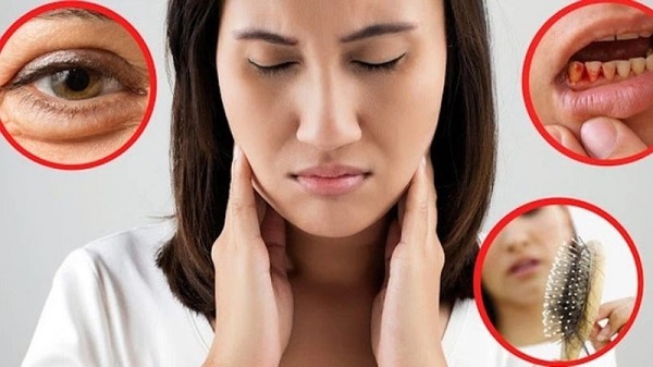 Triệu chứng thiếu vitamin C thường gặp