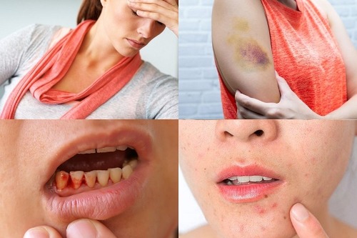 Vai trò của vitamin C đối với sức khỏe