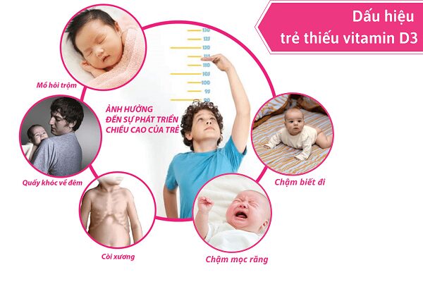 Trẻ em cần được bổ sung đủ vitamin để phát triển toàn diện