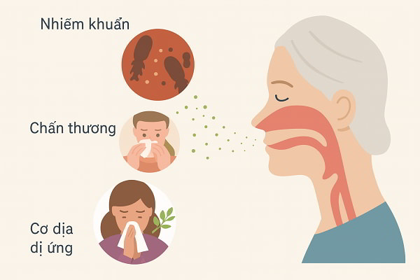 Nguyên nhân viêm xoang hay tái phát do thói quen sinh hoạt