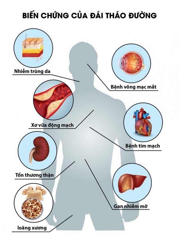 Giải pháp thảo dược hỗ trợ trị tiểu đường