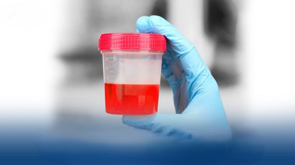 Vai trò của vitamin K đối với cơ thể và sức khỏe tiết niệu