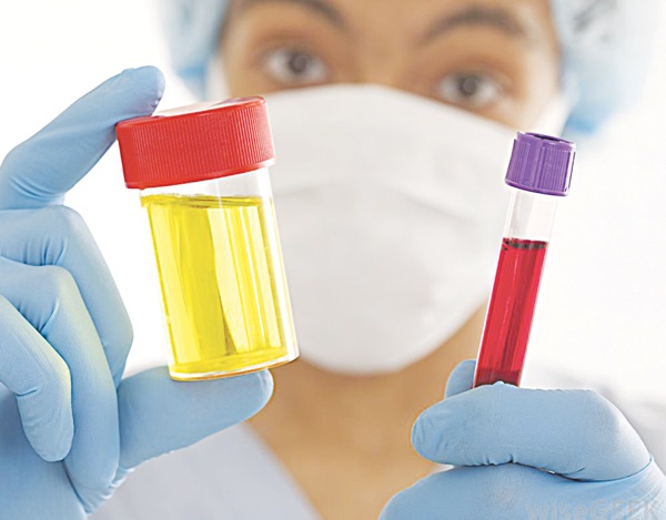 Chế độ ăn giàu vitamin K giúp ngừa tiểu ra máu không do bệnh lý