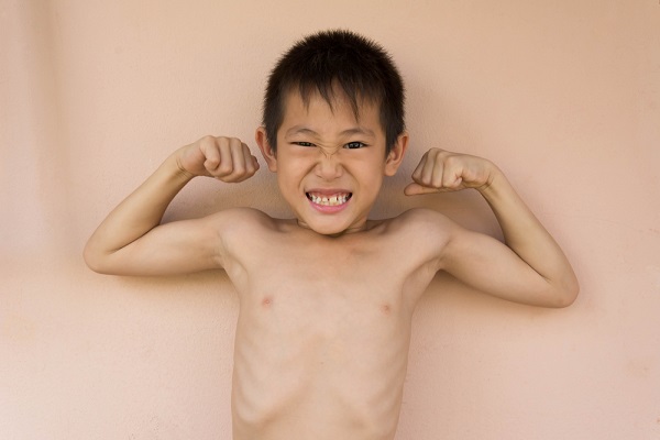 Trẻ còi xương chậm lớn có phải do thiếu canxi