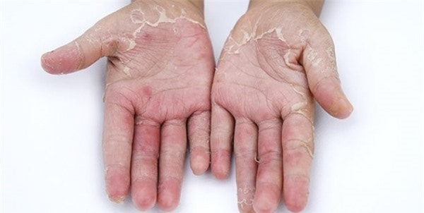 Thực phẩm giàu vitamin C