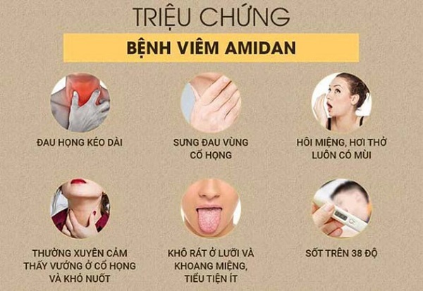 Hình ảnh viêm amidan và cấu trúc tai mũi họng