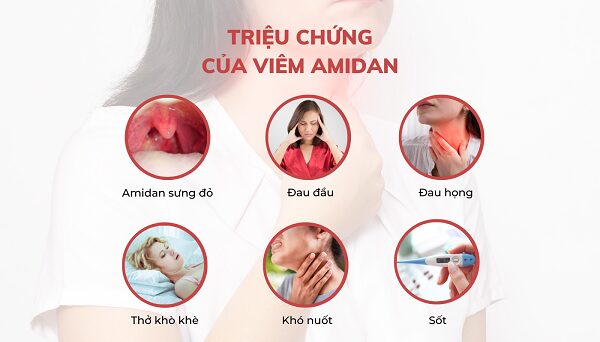 Dấu hiệu nhận biết triệu chứng viêm amidan ở trẻ em và người lớn