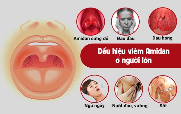 Phòng ngừa viêm amidan và bảo vệ sức khỏe tai mũi họng với thảo dược