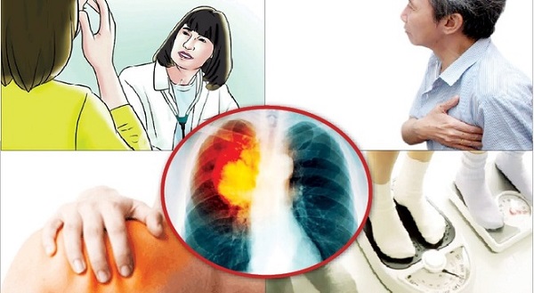 Cảnh báo rủi ro khi sử dụng thảo dược không hợp lý