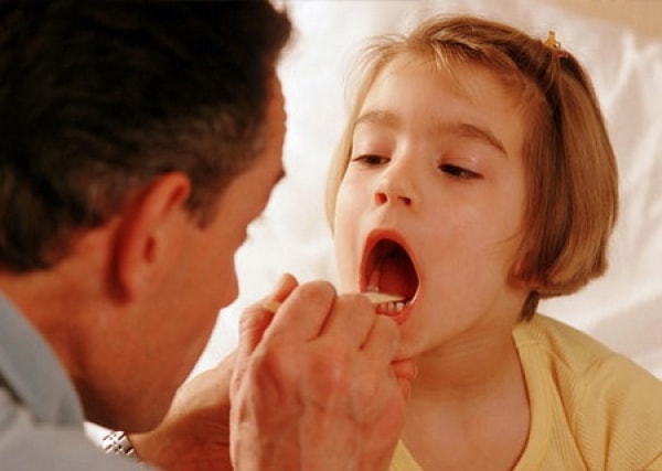 Viêm amidan có lây không? Phân tích nguy cơ và biện pháp phòng tránh