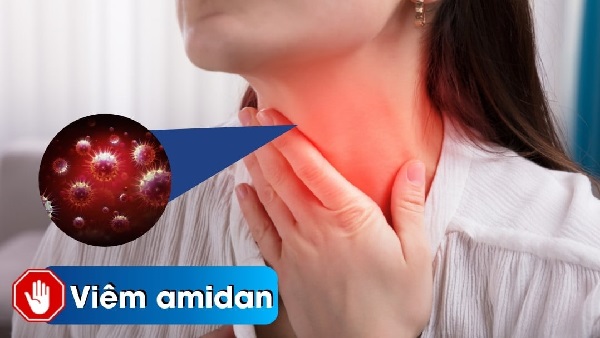 Nguy hiểm từ biến chứng viêm amidan