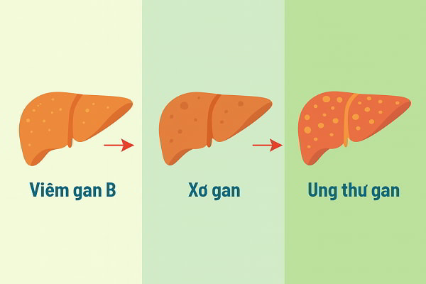 Các nguyên nhân viêm gan và xơ gan