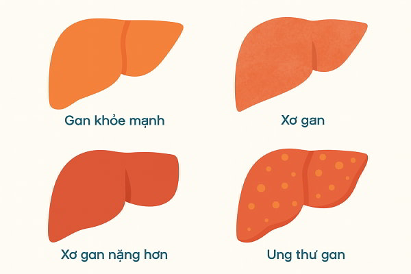 Giải pháp thảo dược chăm sóc gan Tấn Phát
