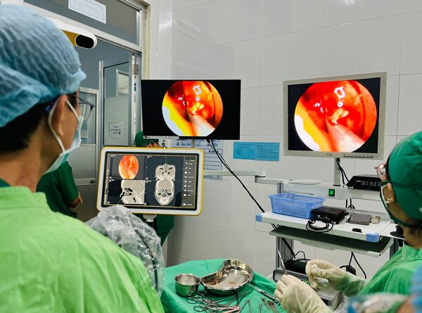 Nội soi họng chuyên nghiệp tại phòng khám