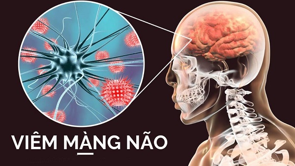 Ảnh hưởng của viêm màng não đến nhận thức và trí nhớ