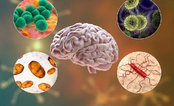 Sự khác biệt giữa các bệnh viêm não và viêm màng não