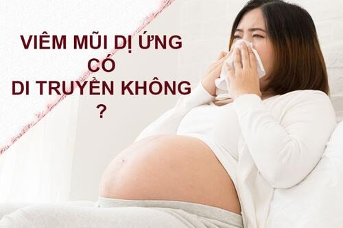 Yếu tố di truyền và môi trường gây viêm mũi dị ứng
