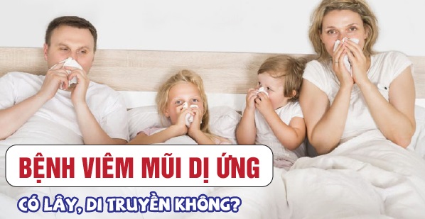 So sánh phương pháp điều trị viêm mũi dị ứng