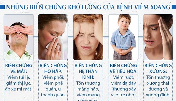 Hình ảnh minh họa các triệu chứng viêm mũi dị ứng