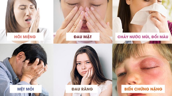 Viêm mũi dị ứng có thể dẫn đến các biến chứng về tai mũi họng