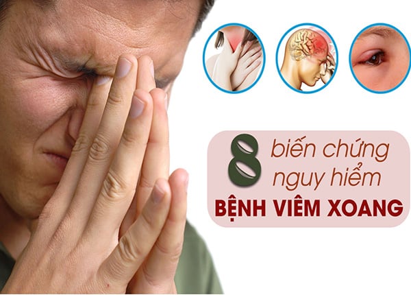 Viêm mũi dị ứng kéo dài dễ dẫn tới biến chứng phức tạp