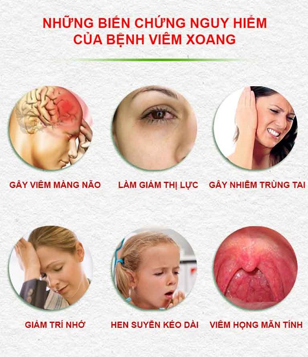 Thảo dược Tấn Phát hỗ trợ phòng và điều trị viêm mũi dị ứng an toàn hiệu quả
