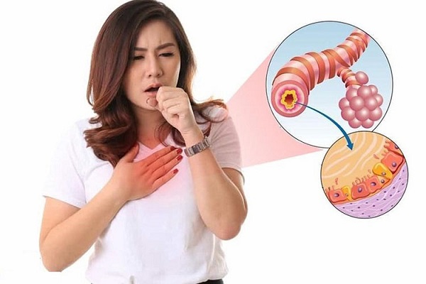 Các nguyên nhân gây viêm phế quản và nguy cơ phát triển thành viêm phổi
