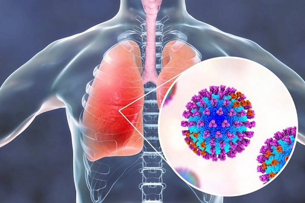 Phòng và điều trị viêm phổi bằng thảo dược đúng cách